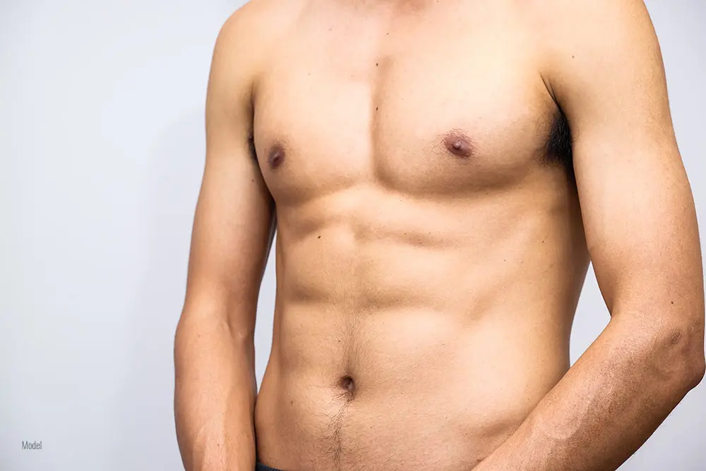Gynecomastia Surgery - 360 Global Health Solutions