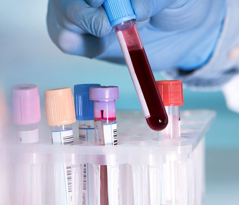 Diabetes Checkup - 360 Global Health Solutions