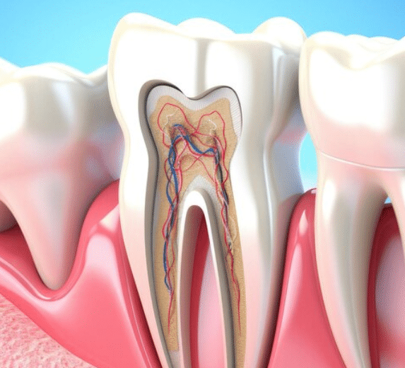 Root Canal Treatment - 360 Global Health Solutions