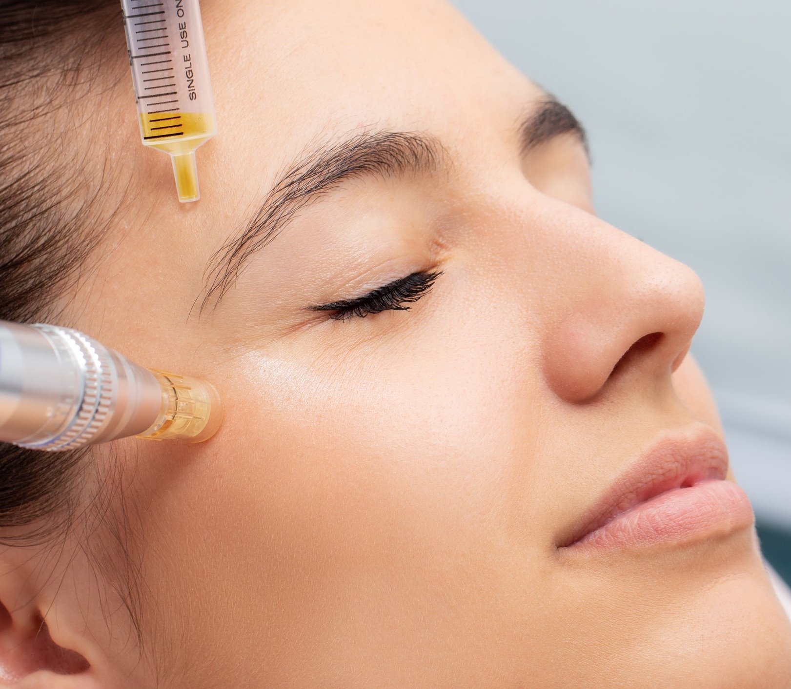 PRP (Platelet-Rich Plasma) Therapy - 360 Global Health Solutions