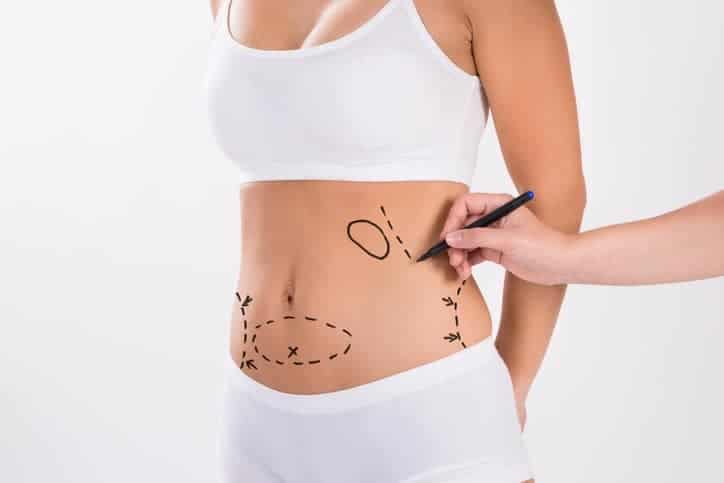 Body Contouring - 360 Global Health Solutions