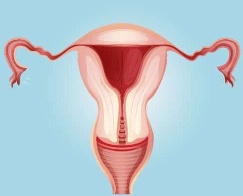 Prophylactic Oophorectomy - 360 Global Health Solutions