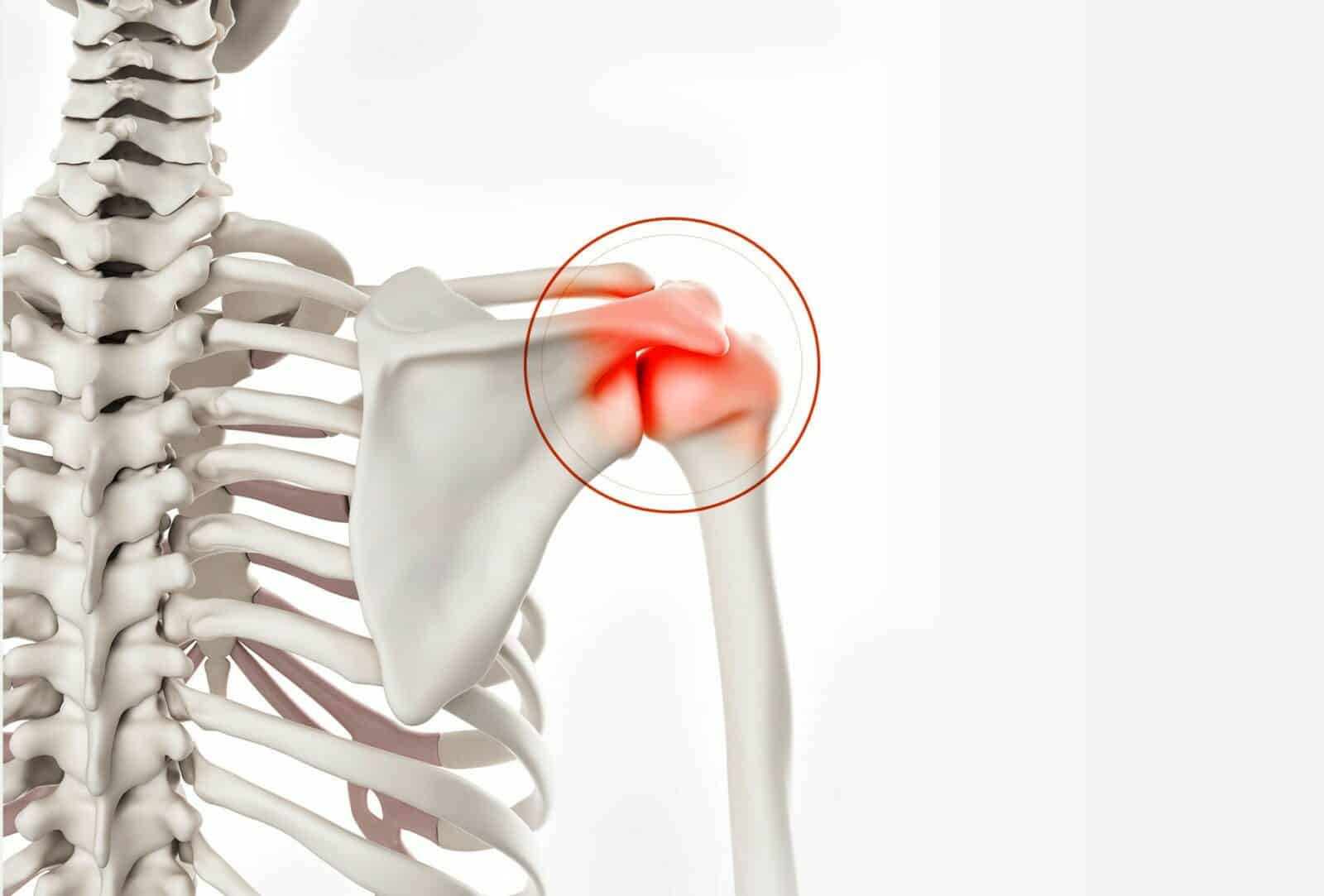 Arthroscopic Surgery - 360 Global Health Solutions