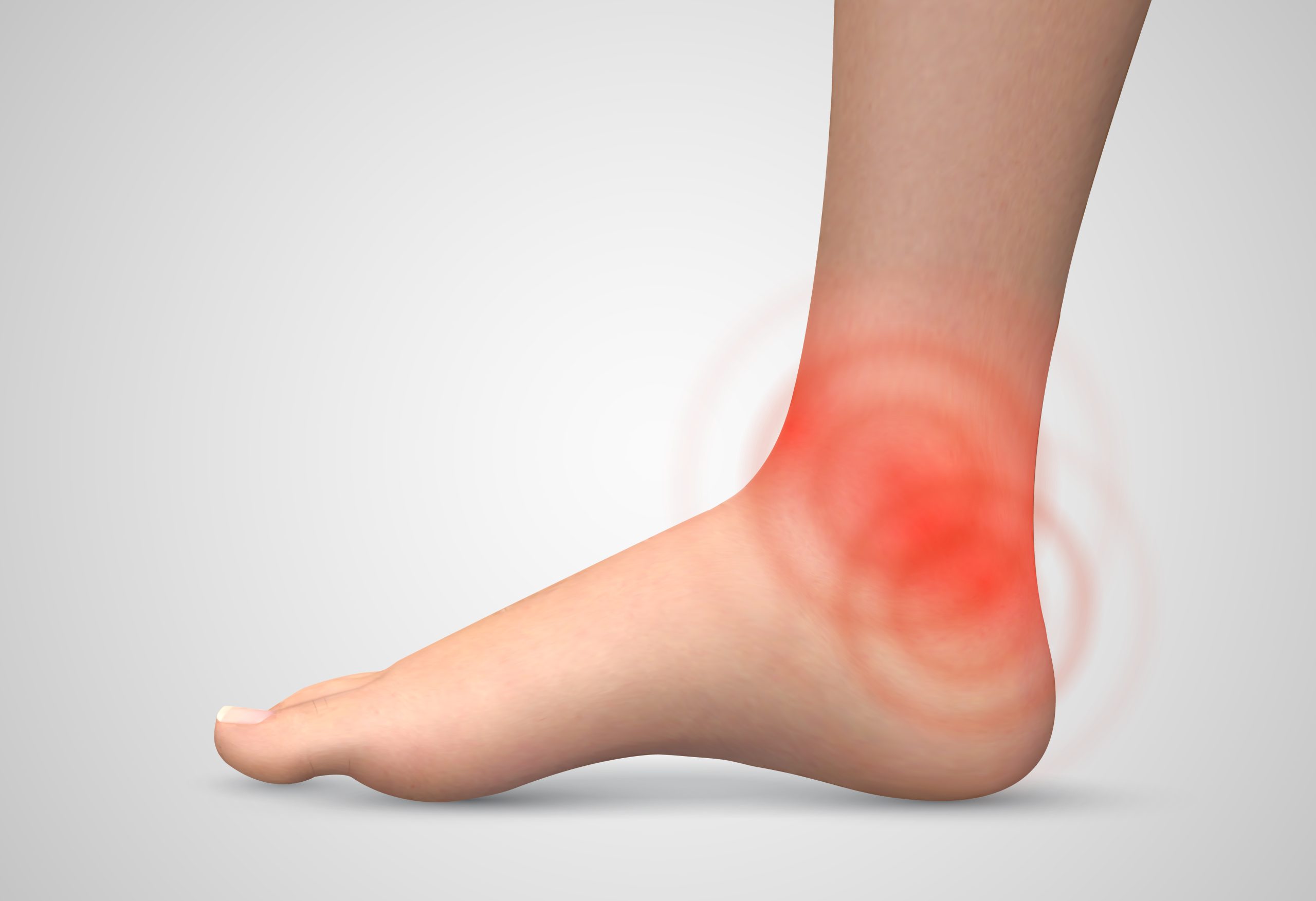 Ankle Fusion Surgery - 360 Global Health Solutions