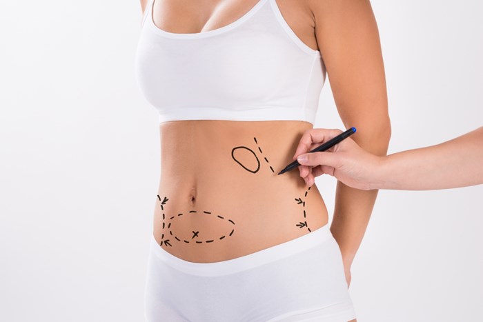 Body Contouring After Bariatric Surgery - 360 Global Health Solutions