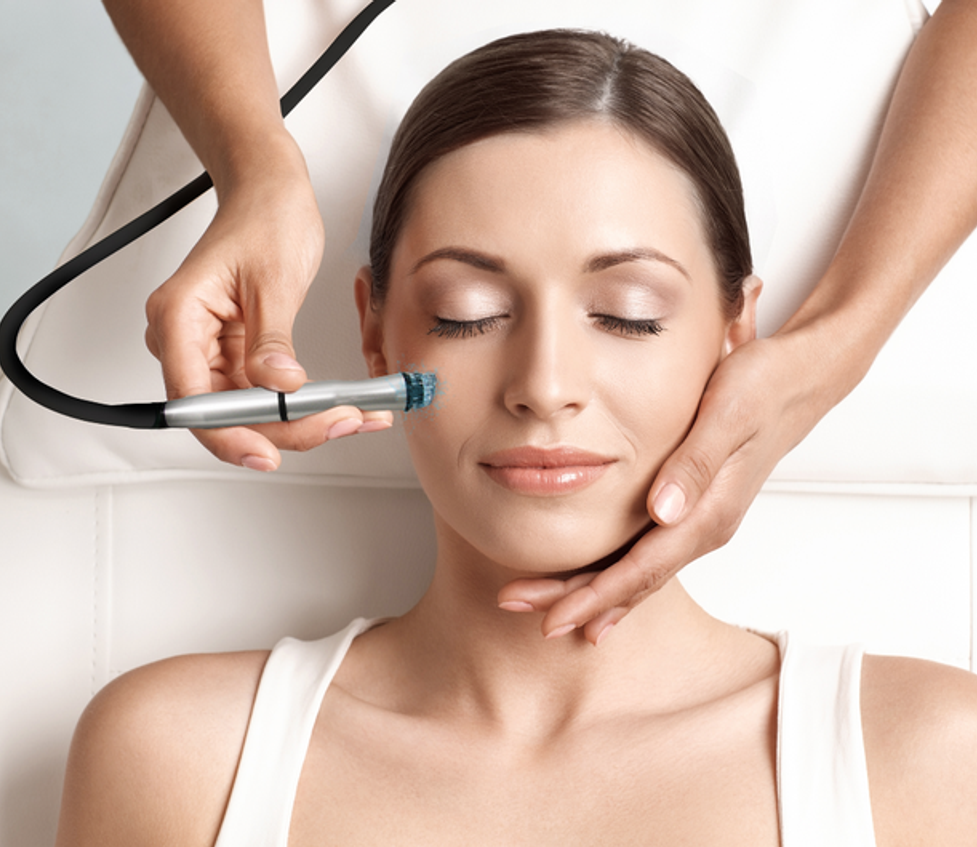 Microdermabrasion - 360 Global Health Solutions