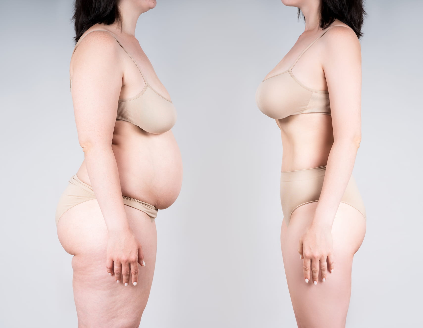Mummy Makeover - 360 Global Health Solutions