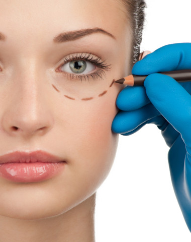 Blepharoplasty - 360 Global Health Solutions