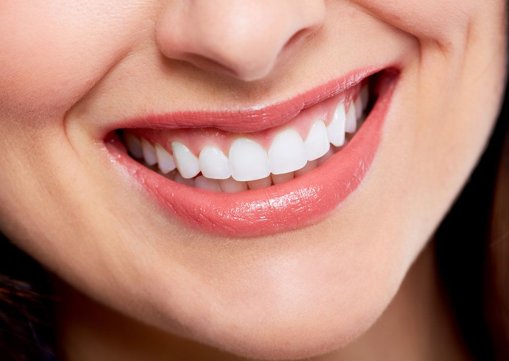 Smile Makeover - 360 Global Health Solutions