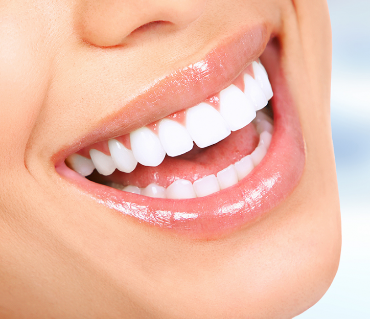 Teeth Reshaping - 360 Global Health Solutions