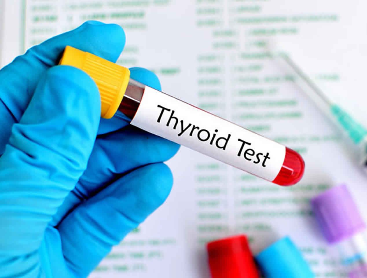 Thyroid Checkup - 360 Global Health Solutions