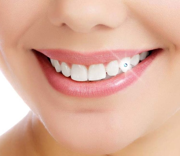 Tooth Jewelry - 360 Global Health Solutions