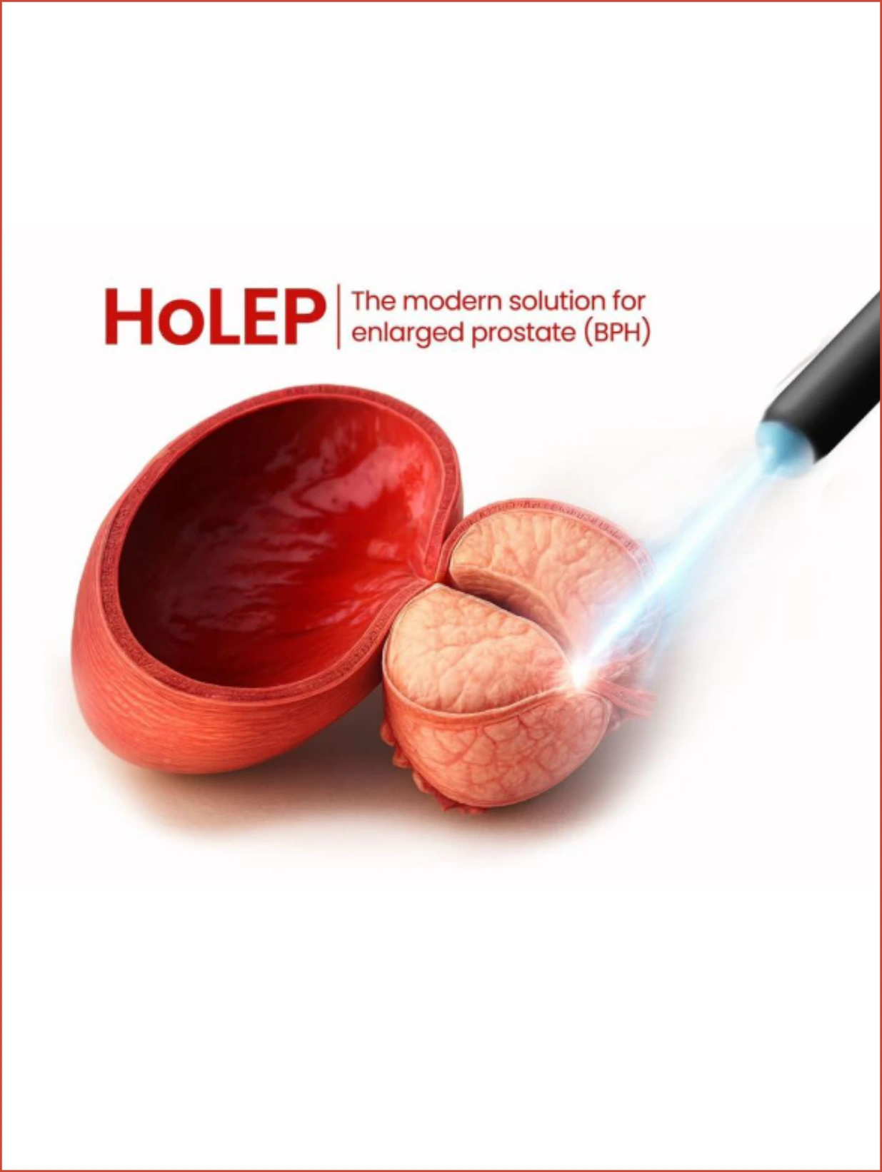 Prostate - 360 Global Health Solutions